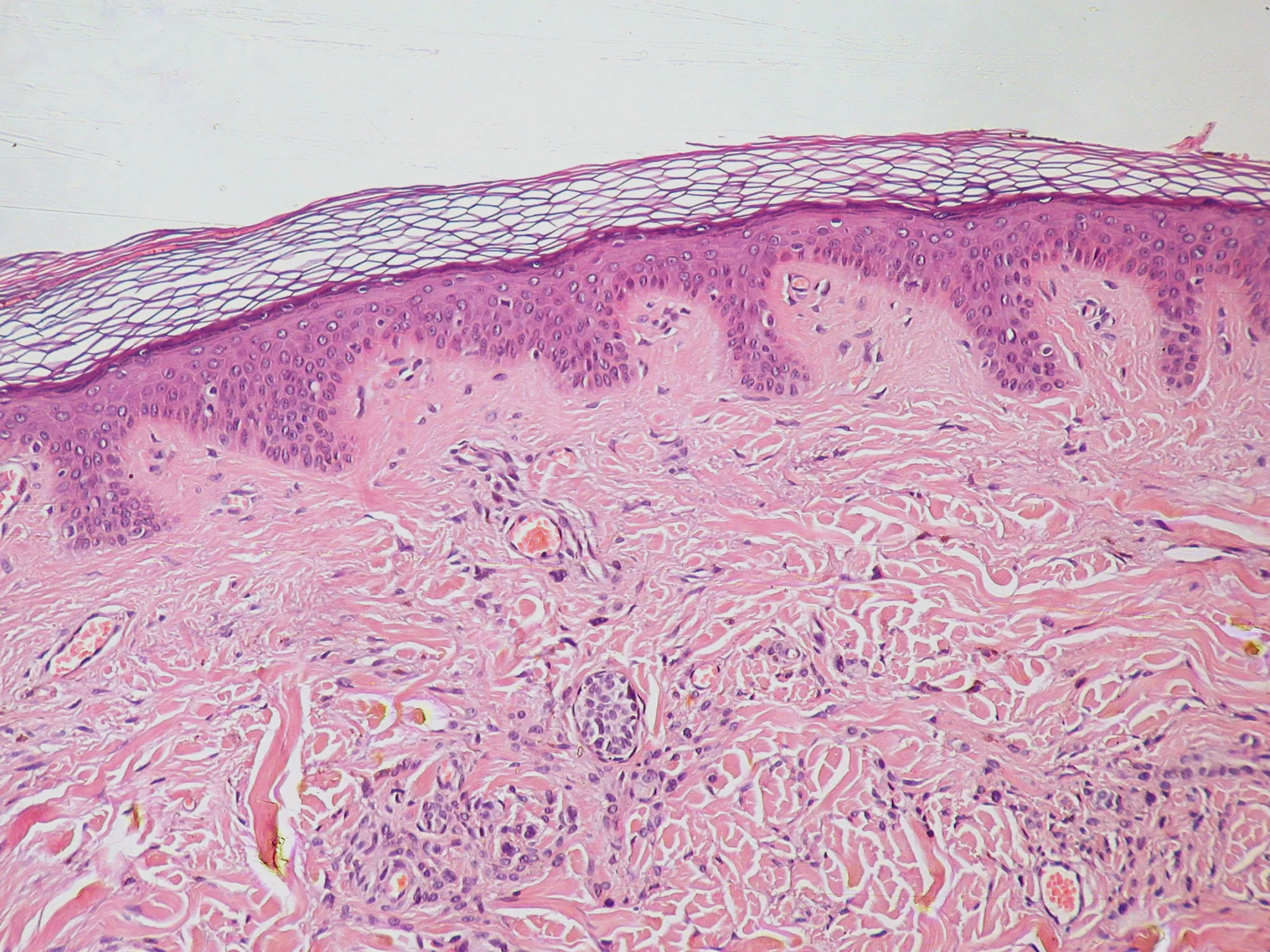 Micrograph of human skin showing the outer horny layer, the epidermis and the collagen of the dermis